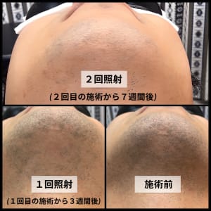 男性歓迎 大阪府で口コミが多い ブラジリアンワックスが得意なエステサロンの検索 予約 楽天ビューティ