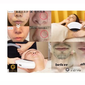 美肌脱毛専門店 Pearl plus 東岡山店【パールプラス】【小顔/痩身