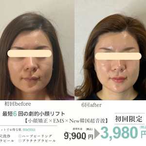【国内美容サロン監修】ハーブピーリング ハーブピーリング専用商品 | 株式会社Dr.Visea/ドクタービセア
