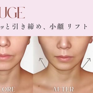 渋谷区で価格が安い】毛穴ケア・毛穴エステが得意なエステサロン30選