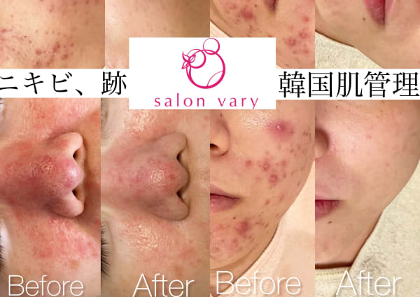 恵比寿 代官山 中目黒でオススメ 痩身 ダイエットエステが得意なエステサロン10選 楽天ビューティ