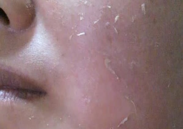 広島市でオススメ ブラジリアンワックスが得意なエステサロンの検索 予約 楽天ビューティ