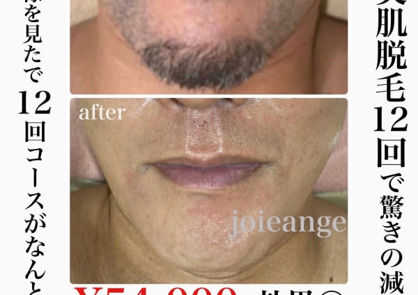 男性歓迎 大阪府でオススメ フェイシャルエステが得意なエステサロン30選 楽天ビューティ