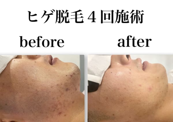 男性歓迎 大阪府でオススメ フェイシャルエステが得意なエステサロン30選 楽天ビューティ