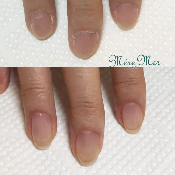 深爪改善|深爪専門ネイルサロンMereMerpetit