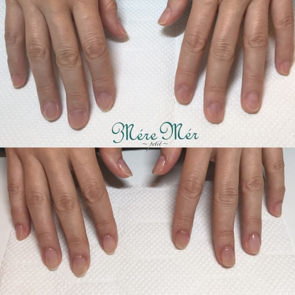 深爪改善メニュー|深爪専門ネイルサロンMereMerpetit