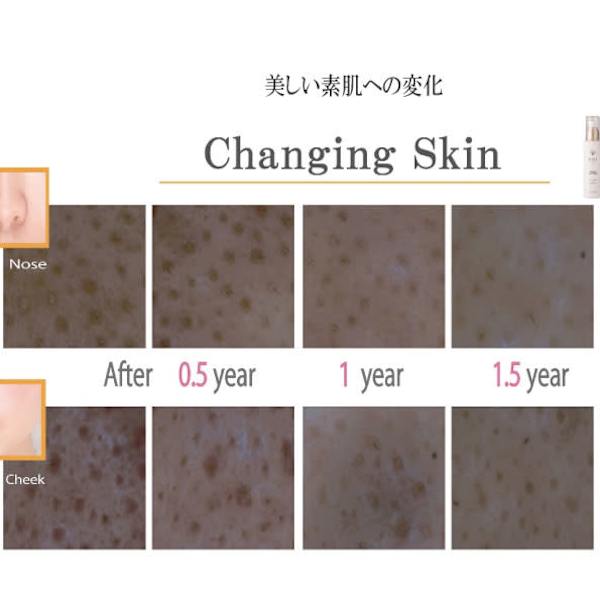 スキンケアサロン銀座「KOKORO」