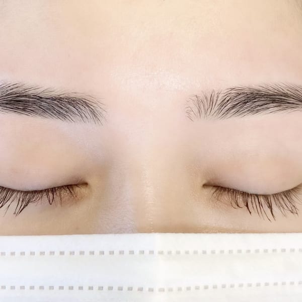 APIS eye