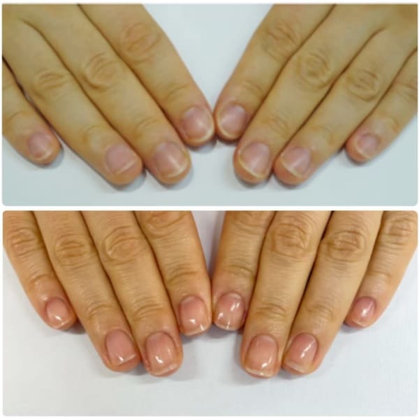 最強のネイルケア　本コース