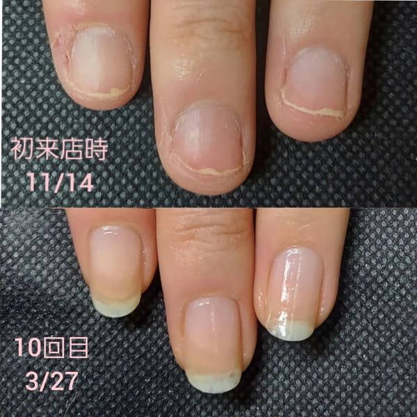 最強のネイルケア　本コース