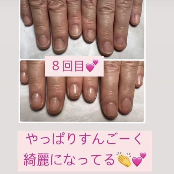 8回目のケアで、、