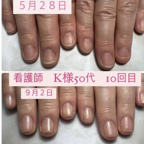 コンプレックス爪が！