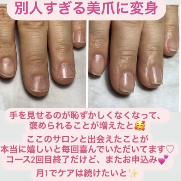 もう恥ずかしくない！