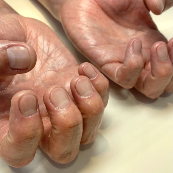 〈ケア〉メンズベーシックコース