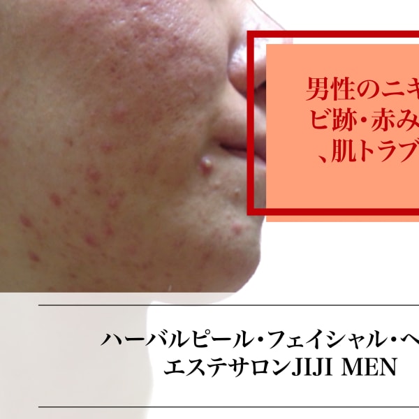 ハーバルピール・フェイシャル/ヘッド専門 エステティックサロンJ IJ I M E N