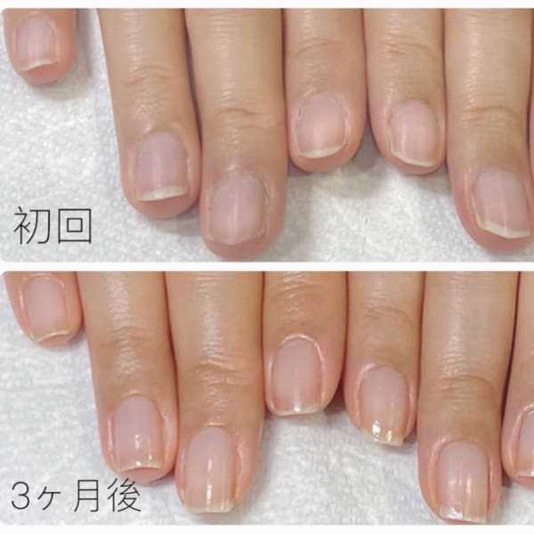 最強のネイルケアコース★