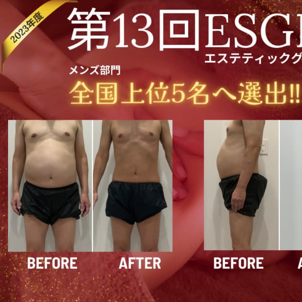 【結果重視・メンズ痩身・小顔・脱毛】Mix up!! 練馬店