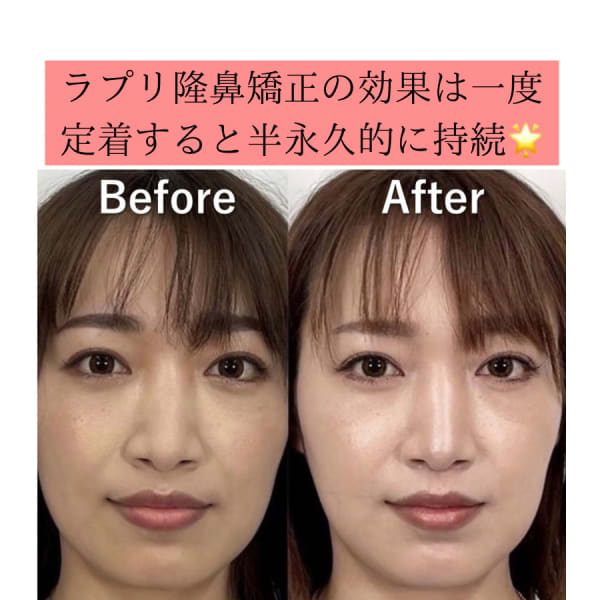 隆鼻矯正専門店 Raplit 福岡博多店