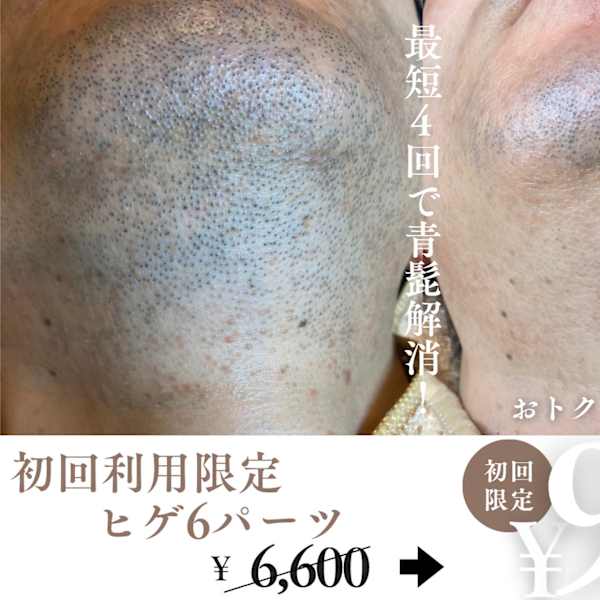 フェイシャル/ヘッドスパ/脱毛専門店ALTO