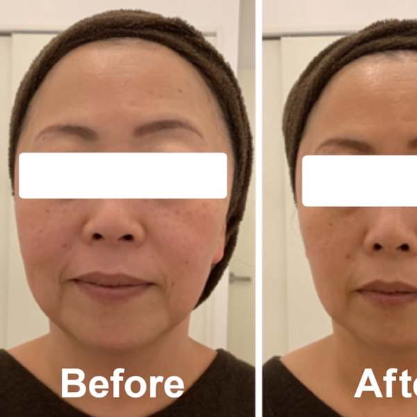 エステティック ルモーロ【Lumoro】