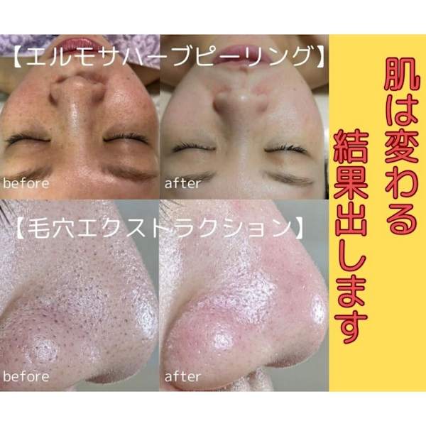 【毛穴ケア&ハーブピーリング専門サロン】La Coquette ラ・コケット