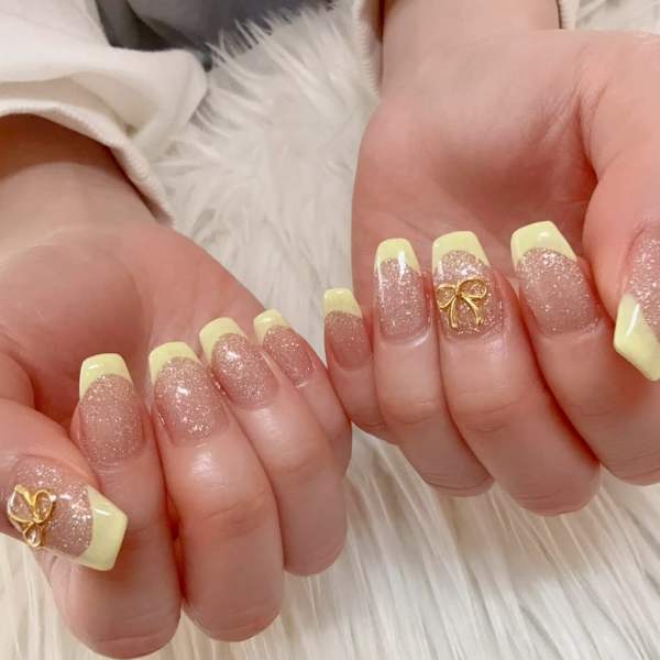 イエローフレンチ✮⋆˙