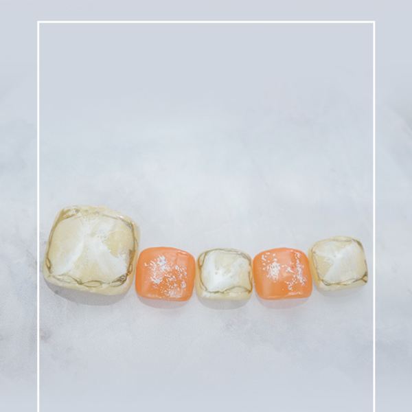 フットネイル：No.107