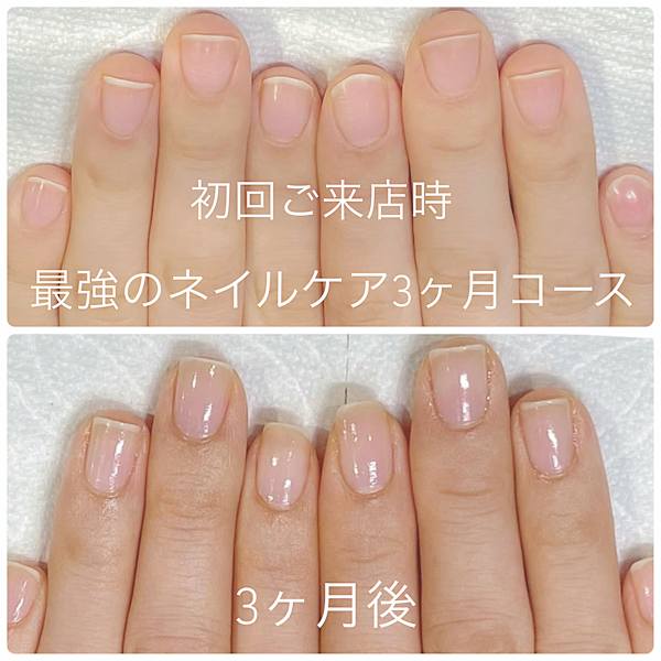 最強のネイルケア(自爪育成3ヶ月コース)症例写真
