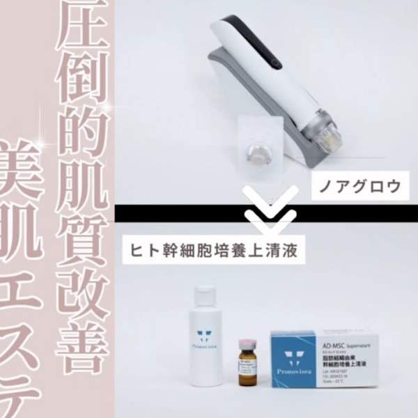 リラクエステ希望