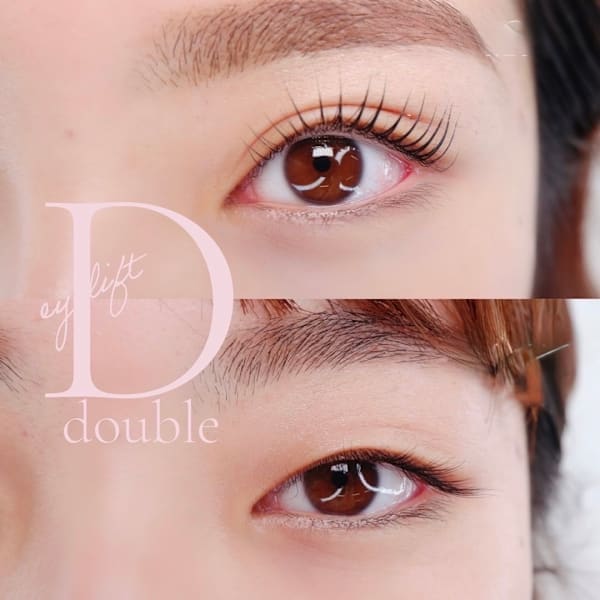 花ユイ -hana youi-