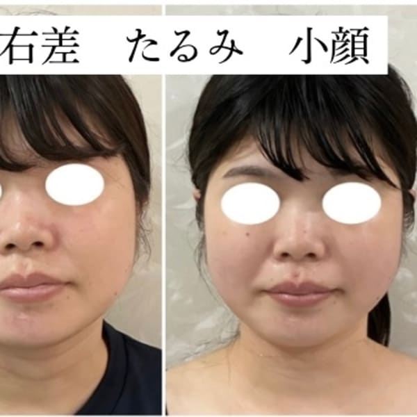 肌質改善サロンNoa