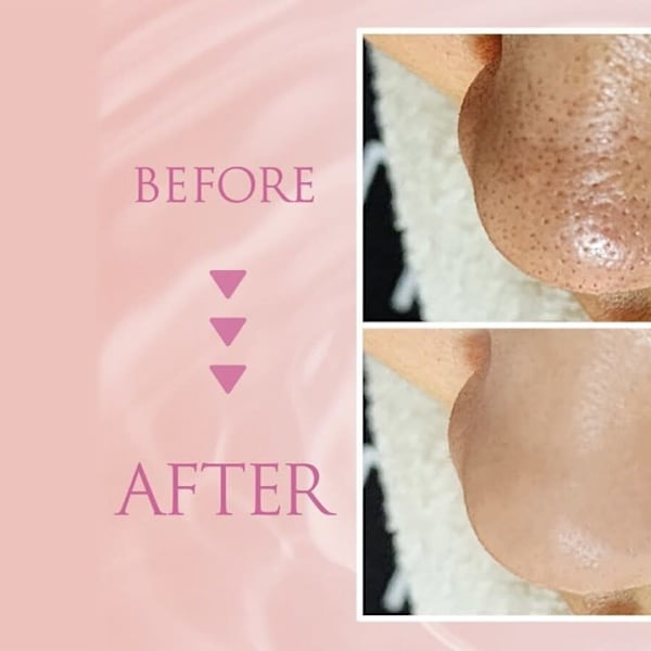 韓国肌管理専門店 Clear Lab 上野【ララピール公認/毛穴洗浄/ハイドラ/ピーリング】