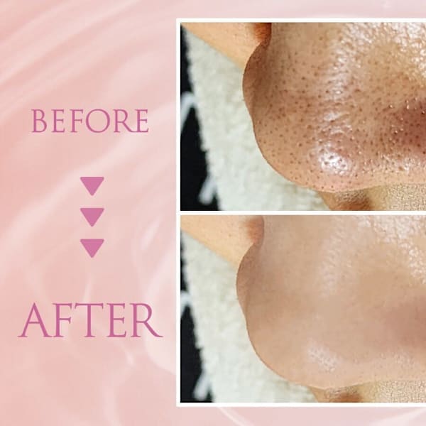 韓国肌管理専門店 Clear Lab 池袋【ララピール公認/毛穴洗浄/ピーリング】