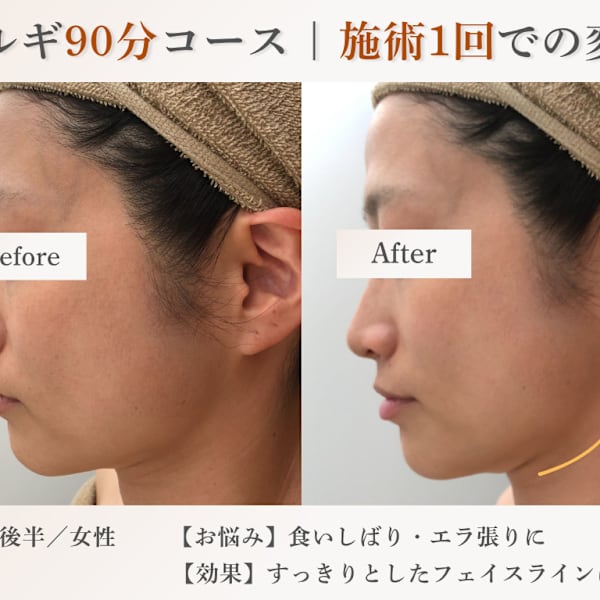 elma～小顔コルギ/肩こり/毛穴/リンパマッサージ/ヘッドスパ/肌管理～