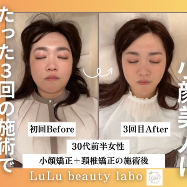 小顔矯正/美容整体 LuLu beauty labo【ルルラボ】