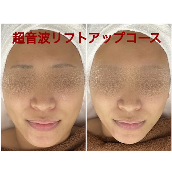 ちゅるん肌.COM 心斎橋店