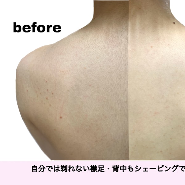 salon.de.SHILO レディースシェービング　麻布十番