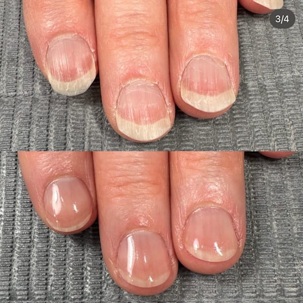 自爪育成初回|Nail Care Salon N