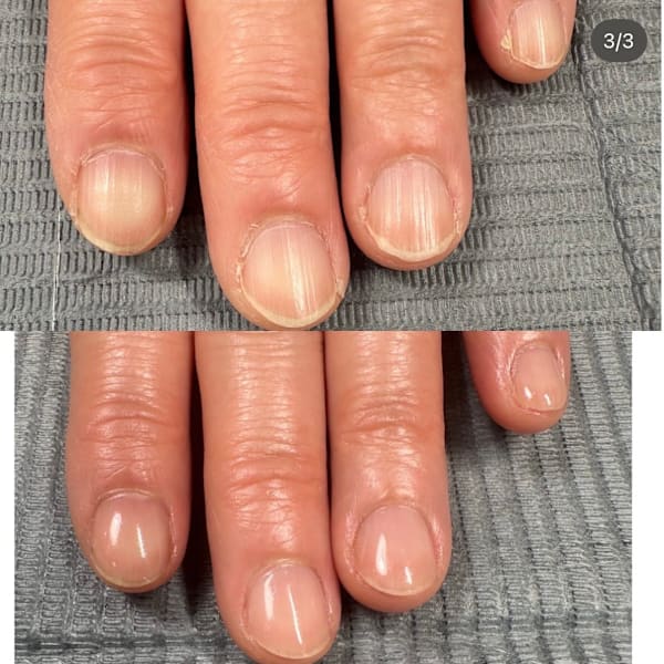 自爪育成|Nail Care Salon N