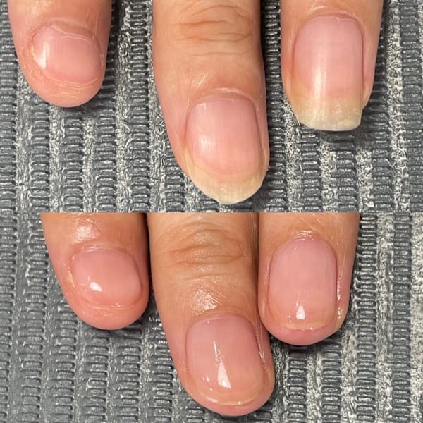 自爪育成|Nail Care Salon N