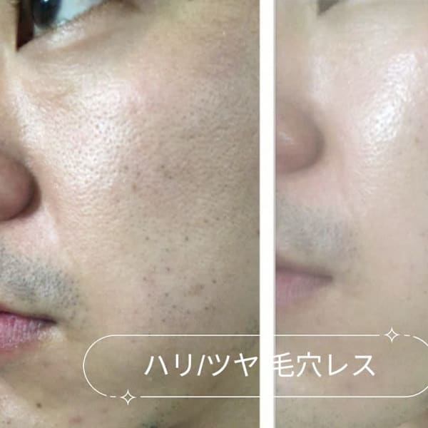 ハーブピーリング&毛穴洗浄サロン MORE SKIN. 南青山店