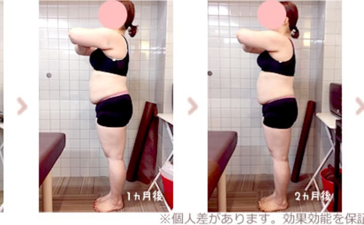 中津市でダイエットやバストアップ．脱毛などの見た目を変える整体