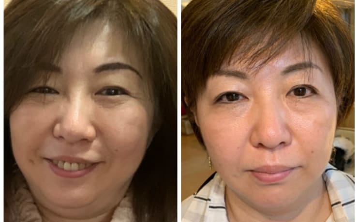 有名エステのパルティール(partir)のSURELINE a です 3.jpg