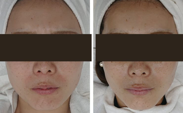 小顔 肌質改善専門elle Beautysalon エル ビューティーサロン の予約 サロン情報 エステサロンを予約するなら楽天ビューティ