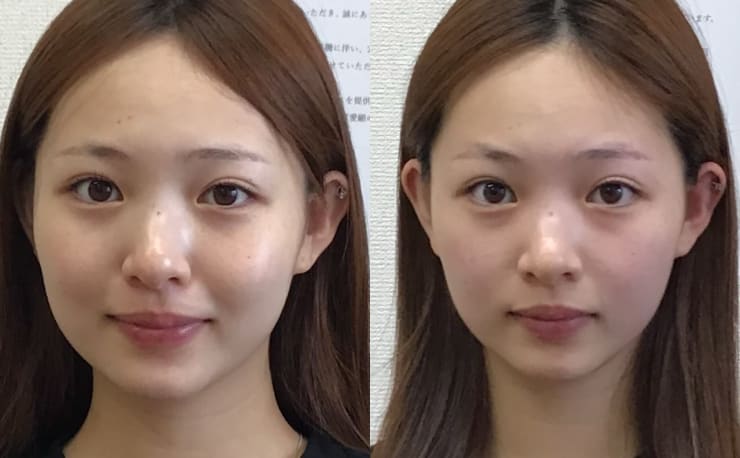 萩原式小顔矯正 オズ六本木 ハギワラシキコガオキョウセイ オズロッポンギ の予約 サロン情報 エステサロンを予約するなら楽天ビューティ