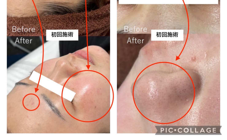 ハーブ美容法―インド三千年の秘伝