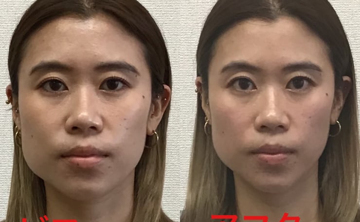磯部式 瞬間小顔矯正法】磯部照弘 整体 手技DVD 治療院マーケティング研究所 | 手技DV