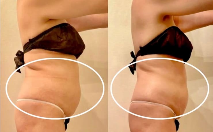 ☆☆痩身で根強い人気のハイパーナイフ☆☆ 痩身で根強い人気のハイパーナイフ 20221001192502.jpg