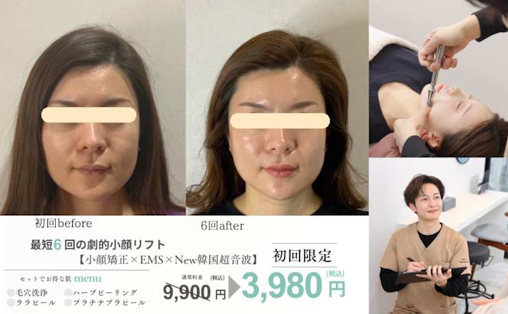 小顔・肌質改善サロンespoir ハーブピーリング/毛穴(コガオ