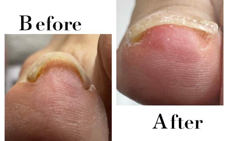 ホームサロンネイル＆ドイツ式フットケアENSIA(ホームサロンネイル